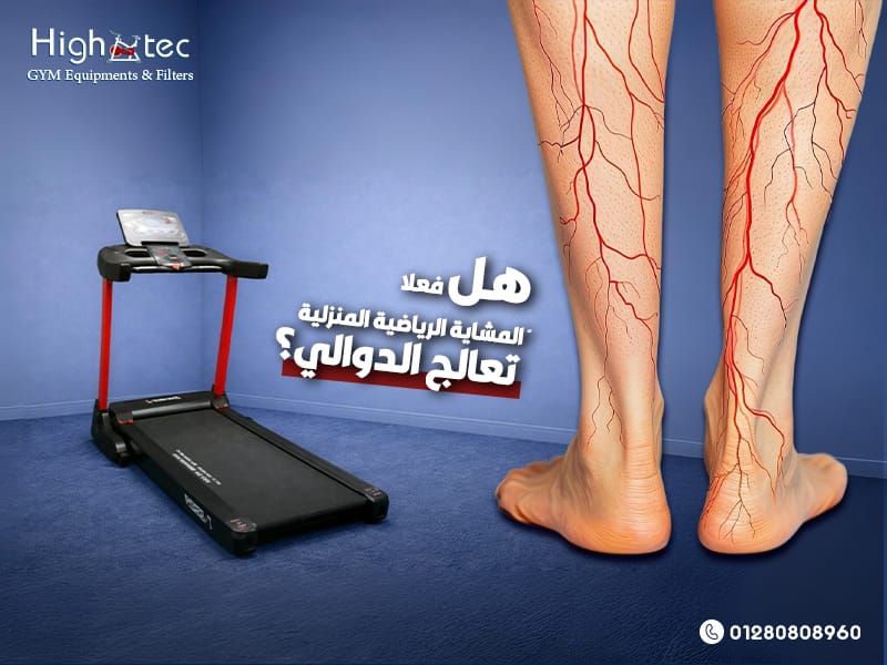 هل فعلاً المشاية الرياضية المنزلية تعالج الدوالي؟